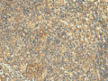 KIAA0513 Polyclonal Antibody – Figure 1 of 3