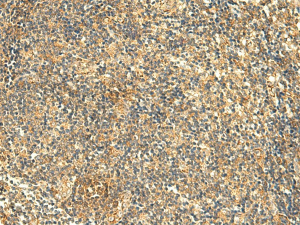 KIAA0513 Polyclonal Antibody – Figure 1 of 3