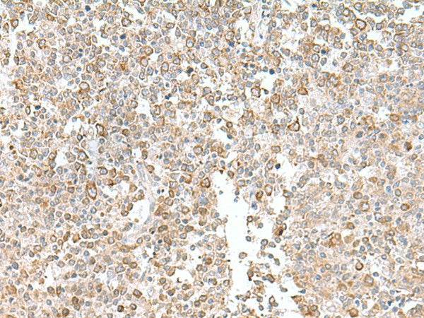 EIF1AY Polyclonal Antibody – Figure 1 of 3