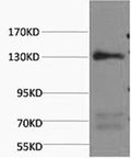 NOS3 Monoclonal Antibody – Figure 1 of 2