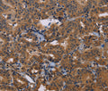 GRK1 Polyclonal Antibody – Figure 1 of 3