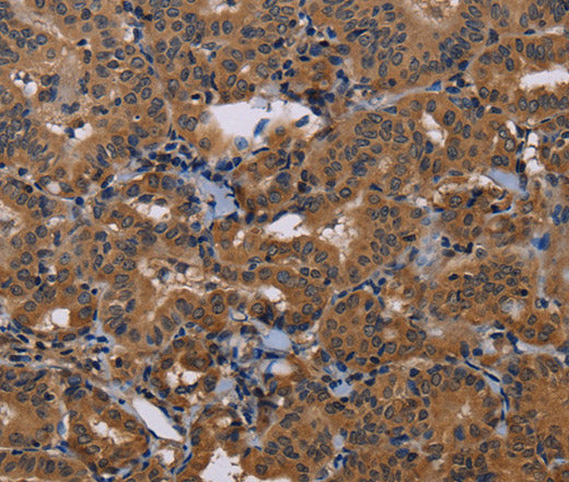 GRK1 Polyclonal Antibody – Figure 1 of 3