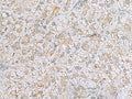 LRRC49 Polyclonal Antibody – Figure 1 of 3