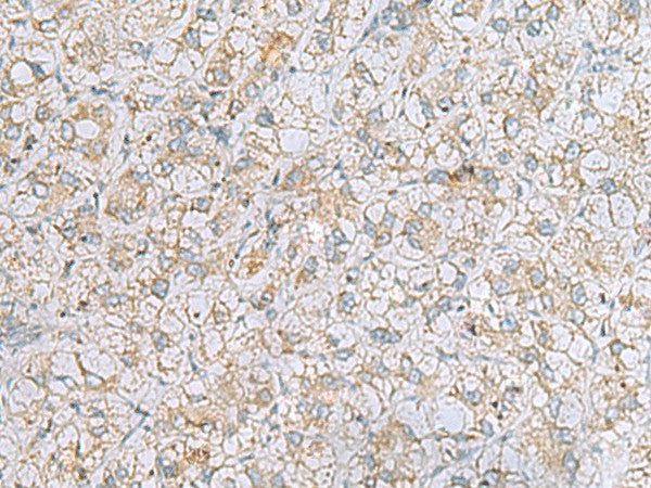 LRRC49 Polyclonal Antibody – Figure 1 of 3