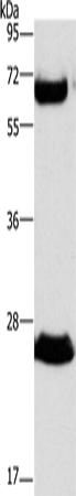 GGT1 Polyclonal Antibody – Figure 1 of 4