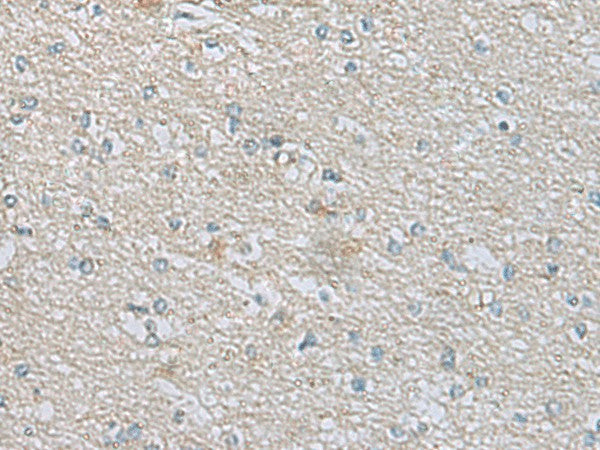 CDH12 Polyclonal Antibody – Figure 1 of 3