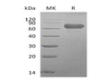 Recombinant Human LTBR/TNFRSF3 Protein (Fc Tag) – Figure 1 of 2