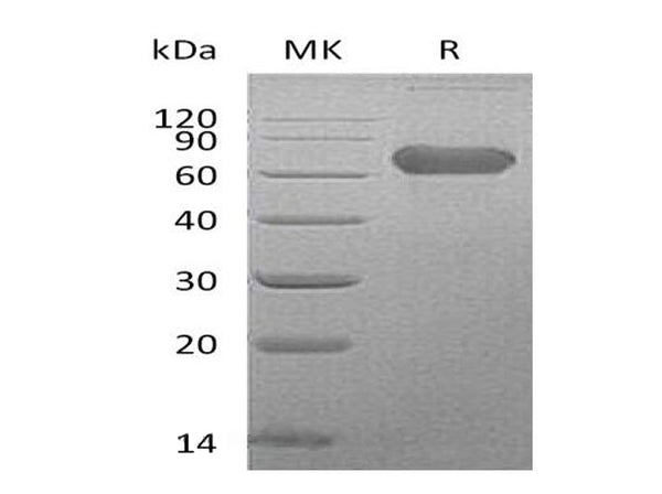 Recombinant Human LTBR/TNFRSF3 Protein (Fc Tag) – Figure 1 of 2