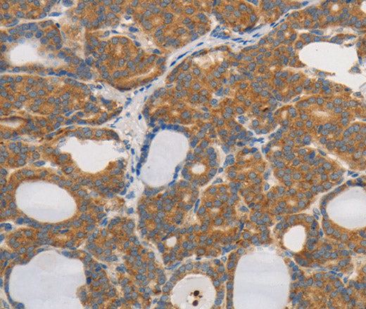 PPP2CB Polyclonal Antibody – Figure 1 of 3