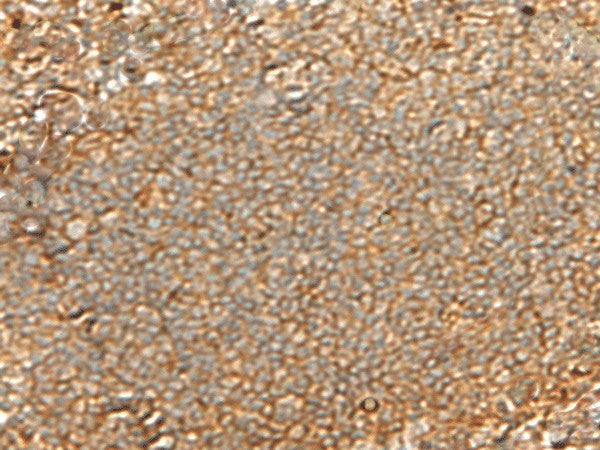 GNGT2 Polyclonal Antibody – Figure 1 of 2