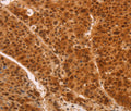 HEXIM1 Polyclonal Antibody – Figure 1 of 3