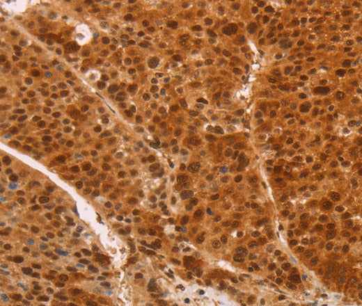 HEXIM1 Polyclonal Antibody – Figure 1 of 3