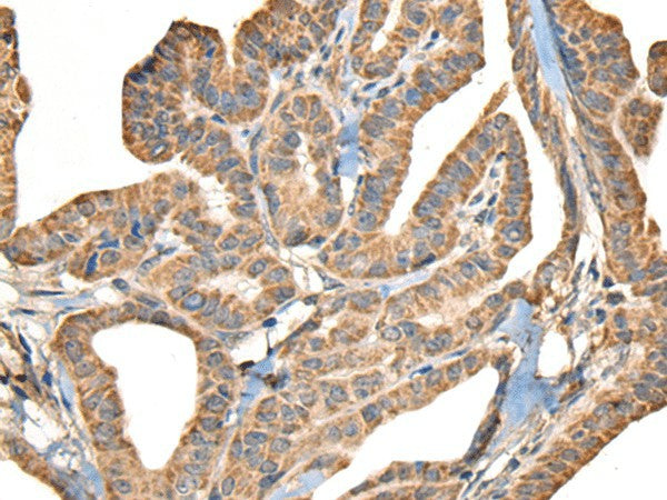 SLAMF7 Polyclonal Antibody – Figure 1 of 3