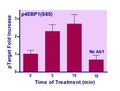 EnzyFluo™ Human/Mouse 4EBP1(S65) Phosphorylation ELISA Kit