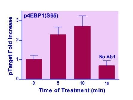 EnzyFluo™ Human/Mouse 4EBP1(S65) Phosphorylation ELISA Kit