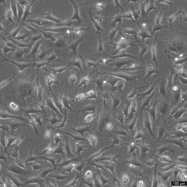 EA.hy926 cell
