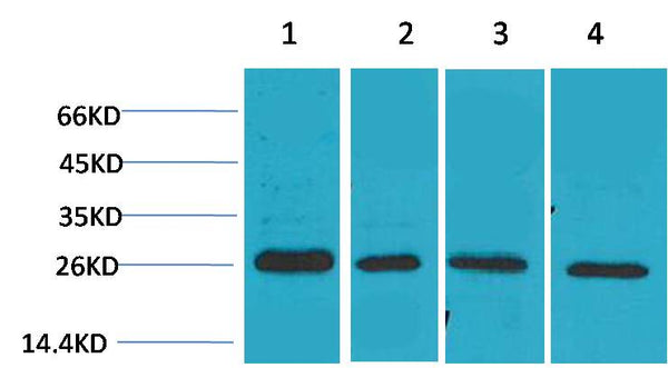 Western blot analysis of 1) MCF7, 2)Mouse Heart Tissue, 3)Rat Heart Tissue, 4)Rat Brain Tissue with SLUG Rabbit pAb EA168 diluted at 1:2,000.