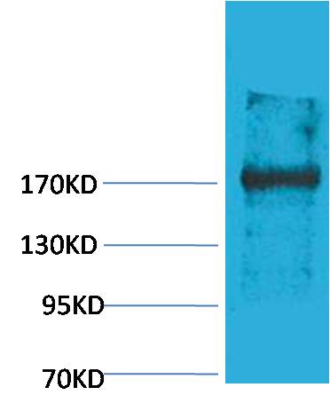 Western blot analysis of Rat Liver Tissue with EPG5 Rabbit pAb EA172 diluted at 1:2,000.