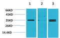 Western blot analysis of 1) Human Brain Tissue, 2) Mouse Brain Tissue, 3)Rat Brain Tissue with Cav γ5 Rabbit pAb EA196 diluted at 1:2,000.