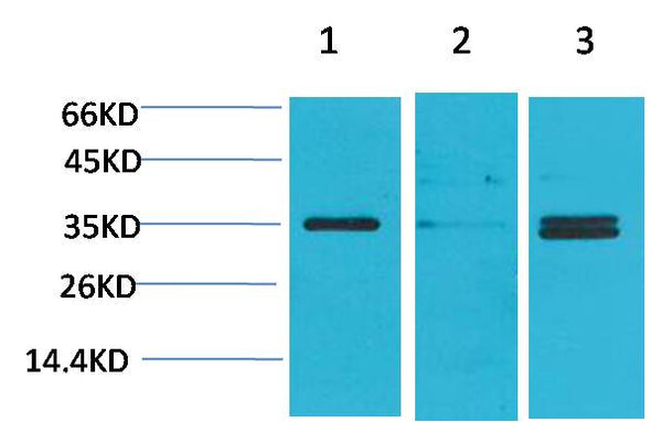 Western blot analysis of 1) Human Brain Tissue, 2) Mouse Brain Tissue, 3)Rat Brain Tissue with Cav γ5 Rabbit pAb EA196 diluted at 1:2,000.