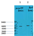 Western blot analysis of 1) Mouse Brain Tissue, 2)Rat Brain Tissue with GABA A Receptor α4 Rabbit pAb EA287 diluted at 1:2,000.