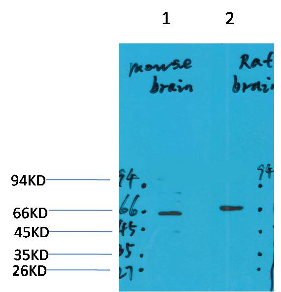 Western blot analysis of 1) Mouse Brain Tissue, 2)Rat Brain Tissue with GABA A Receptor α4 Rabbit pAb EA287 diluted at 1:2,000.