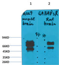 Western blot analysis of 1) Mouse Brain Tissue, 2)Rat Brain Tissue with GABA A Receptor γ2 Rabbit pAb EA289 diluted at 1:2,000.
