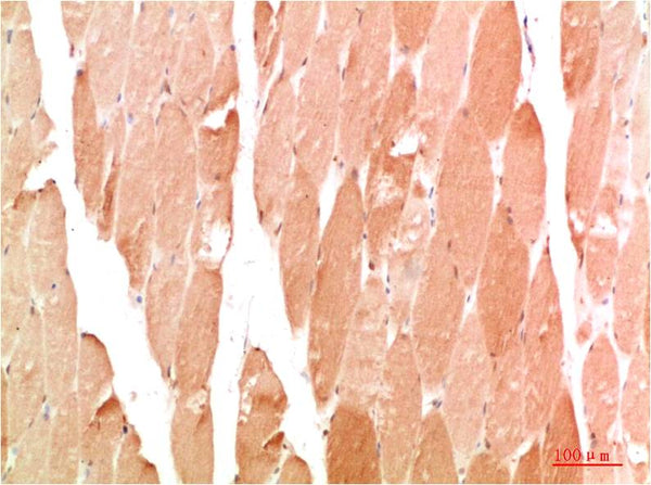 Immunohistochemical analysis of paraffin-embedded Human Skeletal Muslce Tissue using WIPI2 (EA358)Rabbit pAb diluted at 1:200.