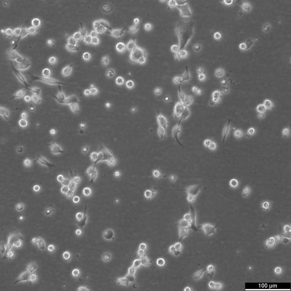 EBC-1 cell