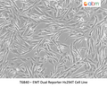 EMT Dual Reporter Hs294T Cell Line | Applied Biological Materials (abm)