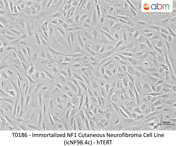 Immortalized NF1 Cutaneous Neurofibroma Cell Line (icNF98.4c) - hTERT – Figure 1 of 1