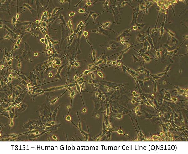 Human Glioblastoma Tumor Cell Line (QNS120) | Applied Biological Materials (abm)