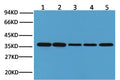 Western blot analysis of Hela (1), Rat brain (2), Rabbit Muscle(3), Sheep Muscle(4), and Mouse brain (5) with GAPDH mouse mAb(2B8) diluted at 1:10,000.