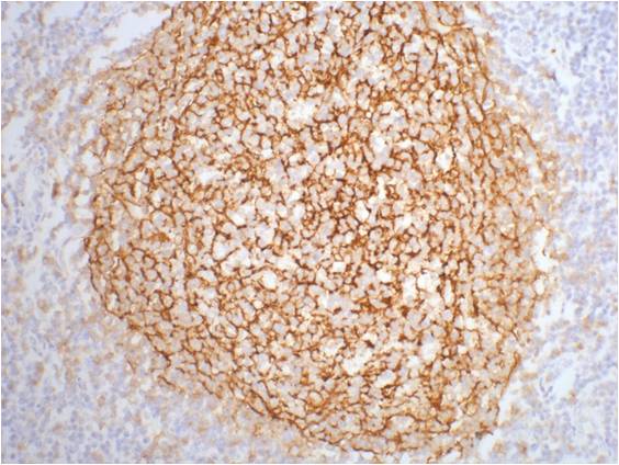 CD21 Mouse mAb – Figure 1 of 1