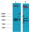 Western blot analysis of 1) Hela, 2) HepG2,with IDE Mouse mAb diluted at 1:2,000.