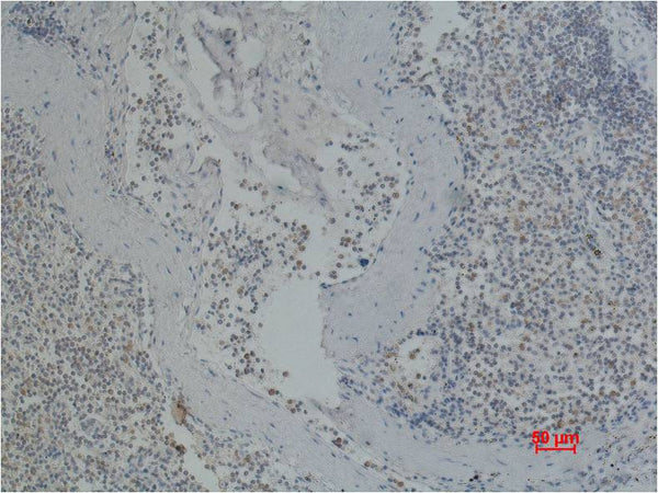 CD41/Integrin α/2b Mouse mAb – Figure 1 of 1