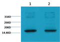Western blot analysis of Hela with EM1109 diluted at 1) 1:2,000 2) 1:5,000