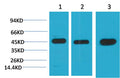 Western blot analysis of 1) Hela, 2)3T3, 3) Rat Brain Tissue with MEK2 Mouse mAb EM1205 diluted at 1:2,000.
