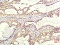 IL-8 (13F8) Mouse mAb – Figure 1 of 2