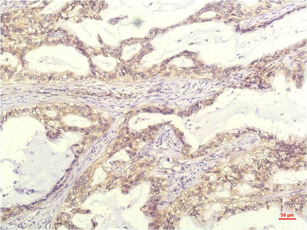 IL-8 (13F8) Mouse mAb – Figure 1 of 2