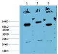 Western blot analysis of 1) Hela Cell Lysate, 2) 3T3 Cell Lysate, 3) Rat Brain Tissue Lysate using Ubiquitin (EM1296) Mouse mAb diluted at 1:1000.