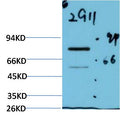 Western blot analysis of Firefly LuciferaseTransfected Hela Cell Lysate using Luciferase(EM1305)Mouse mAb diluted at 1:2000.