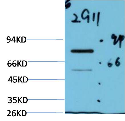 Western blot analysis of Firefly LuciferaseTransfected Hela Cell Lysate using Luciferase(EM1305)Mouse mAb diluted at 1:2000.