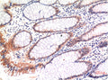 phospho-MLKL (S358) (6B4) Mouse mAb – Figure 1 of 2