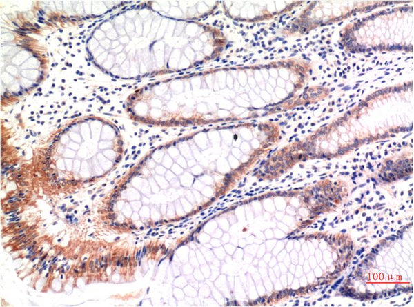 phospho-MLKL (S358) (6B4) Mouse mAb – Figure 1 of 2
