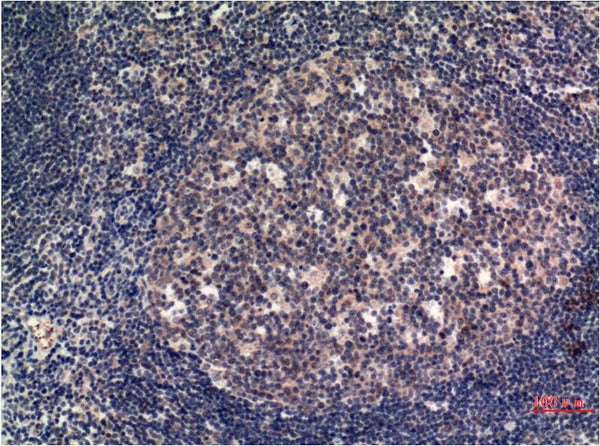 MLKL (8H7) Mouse mAb – Figure 1 of 2