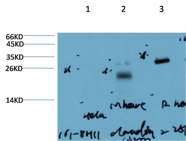 Claudin-2 (8H11) Mouse mAb – Figure 1 of 3