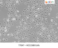 HCC1588 Cells – Figure 1 of 1