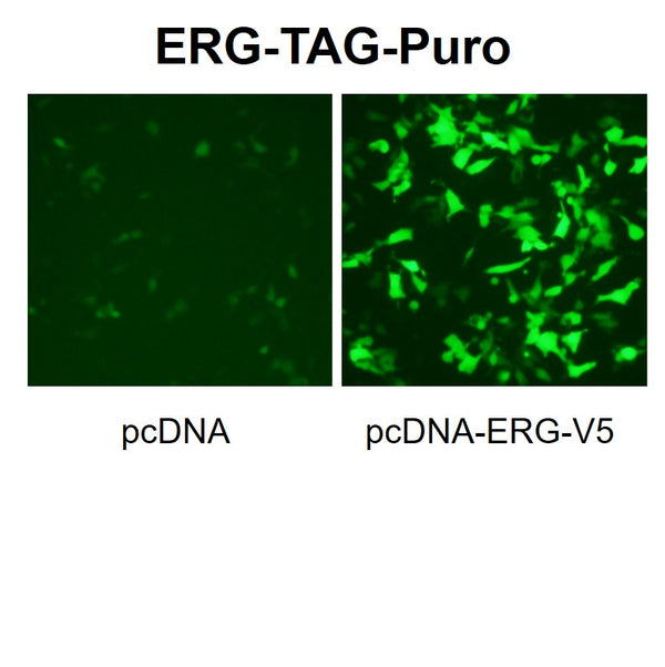 ERG Reporter Lentivirus – Figure 1 of 7