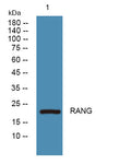 Western blot analysis of lysates from SW480 cells, primary antibody was diluted at 1:1000, 4°over night